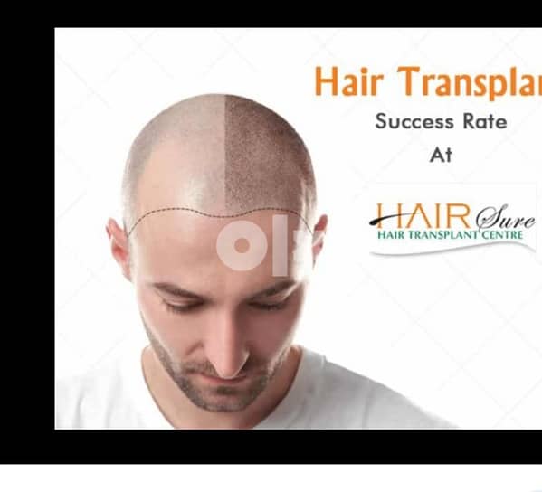 we need hair transplant technician - Medical - Health - 127046714